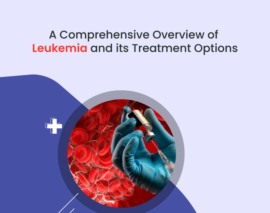 A Comprehensive Overview Of Leukemia And Its Treatment Options